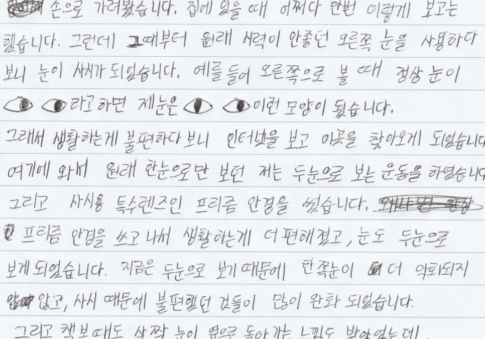 짝눈을 빠르게 회복할 수 있었던 방법